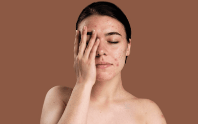 Common Skin Problems and How to Fix Them