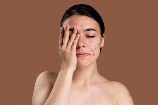 Common Skin Problems and How to Fix Them