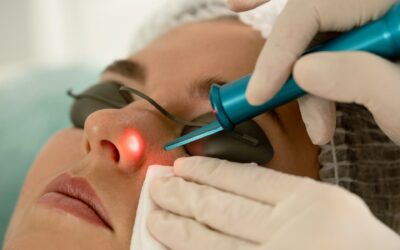 Common Myths About Laser Skin Treatments Debunked